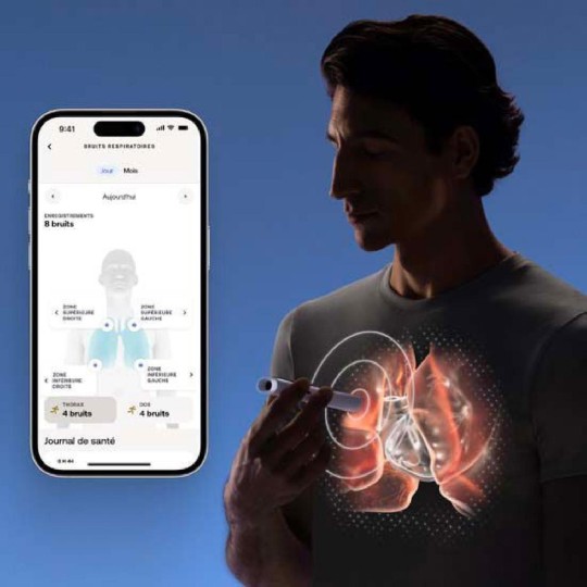 Withings Beam'O Διαγνωστική Συσκευή Ελέγχου Υγείας 4-in-1 (WI-SCT02-02) Λευκή